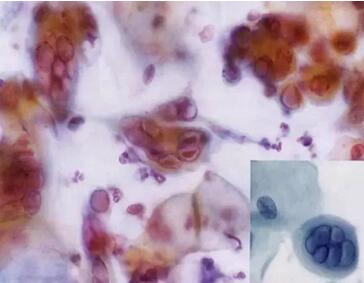 ���(l��i)ϴ���ӣ��������ךW���M(j��n)�ھ�ϴ�O���ꑌ�������Ҽ�